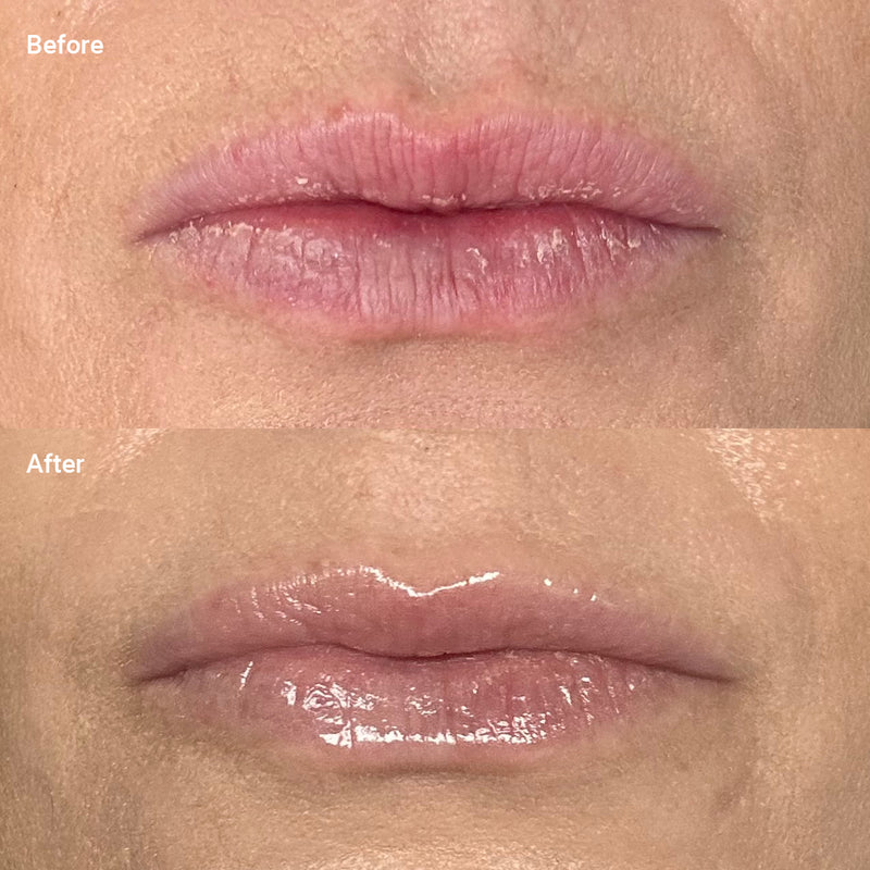 woman's lips before and after using Cinch Skin Minty Glow lip balm