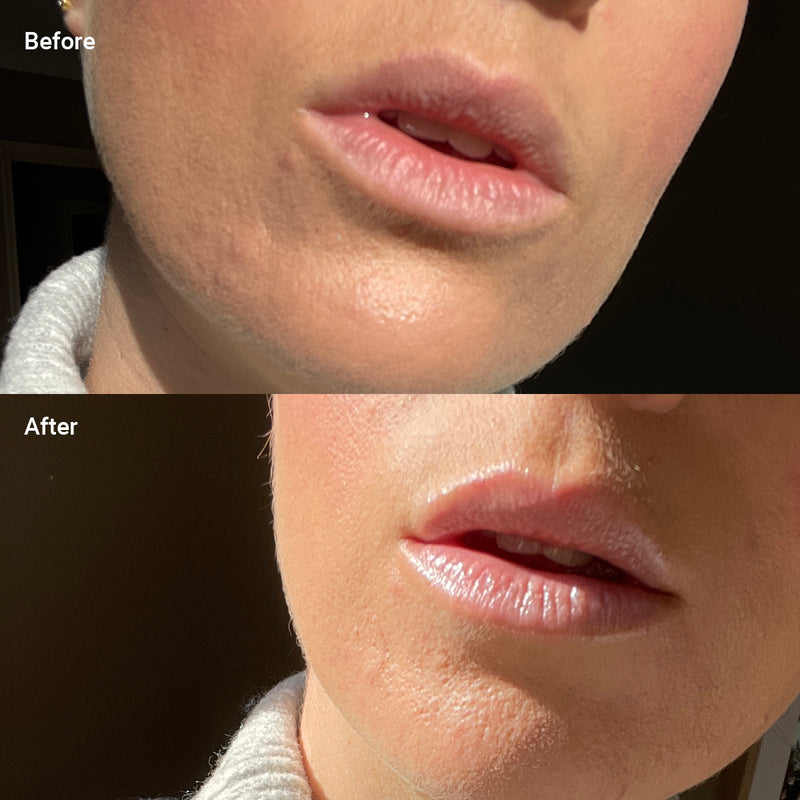 woman showing his lips before and after using Minty Glow Lip Balm